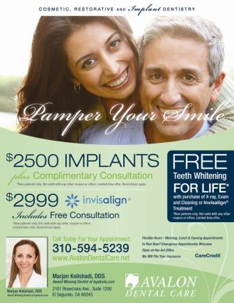 Carson_Porcelain_Veneers